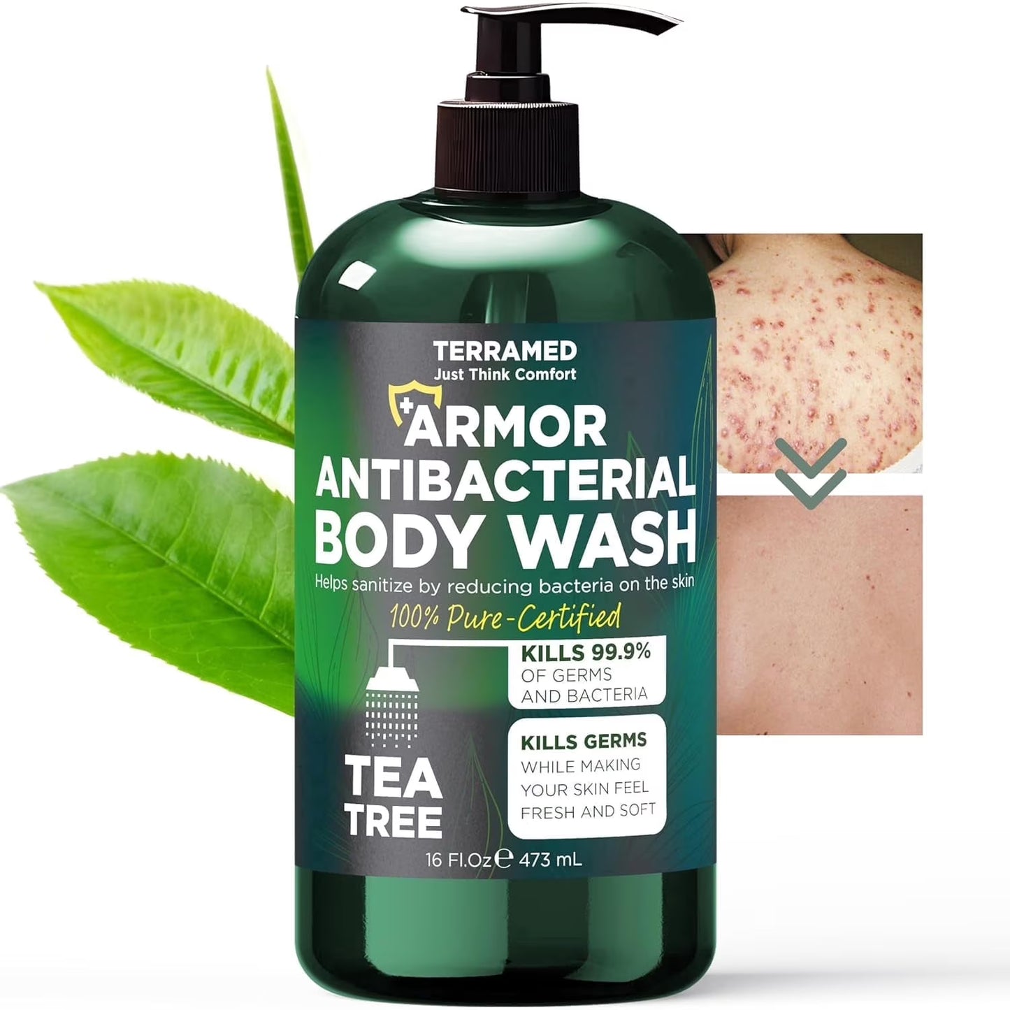 Antibacterial Body Wash with Tea Tree Oil (16 oz)
